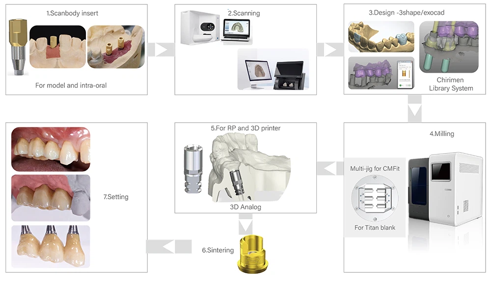 Dental CADCAM System Workflow Dental CADCAM System Workflow
